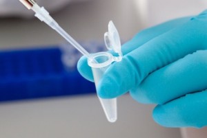 Laboratory micro pipette drops the biological solution in eppendorf